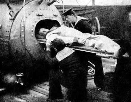 Putting a diver suffering from bends into the recompression chamber